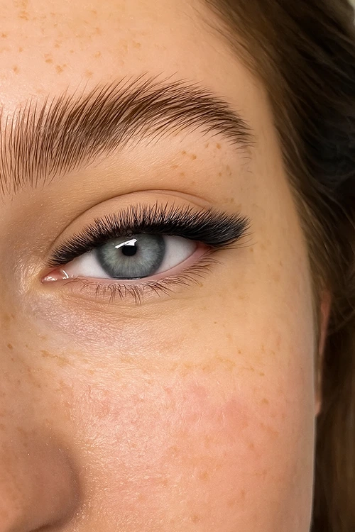 épilation laser, Eye Designer, épilation, laser, Épilation Définitive au Laser, Laser hair removal